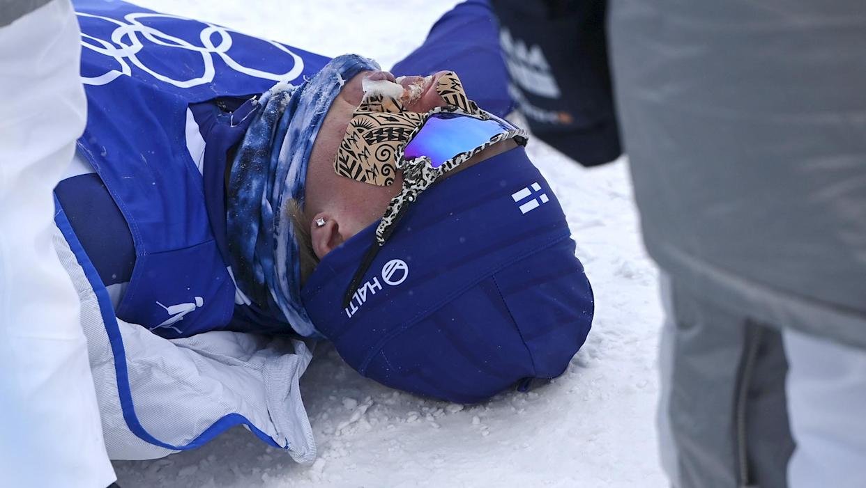 Πάγωσαν τα γεννητικά του όργανα: Ατύχημα στους Χειμερινούς Ολυμπιακούς