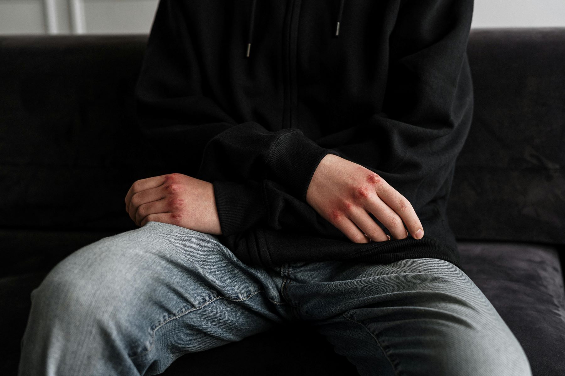 Επίθεση με ρόπαλα Χαλκίδα: Θύματα δύο 15χρονοι και ένας 20χρονος