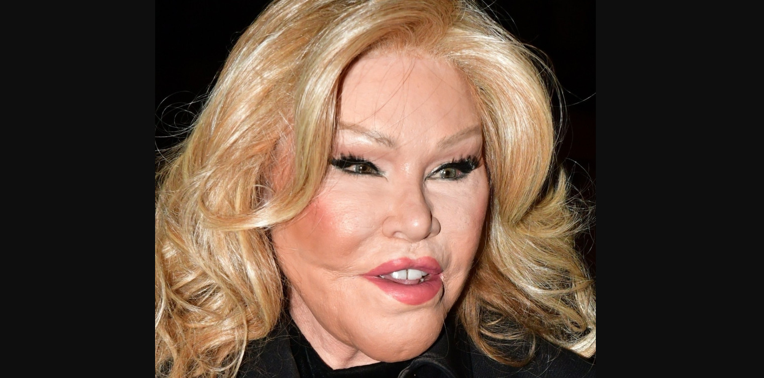 Jocelyn Wildenstein πλαστικές: «Δεν έχω κάνει ποτέ επέμβαση»